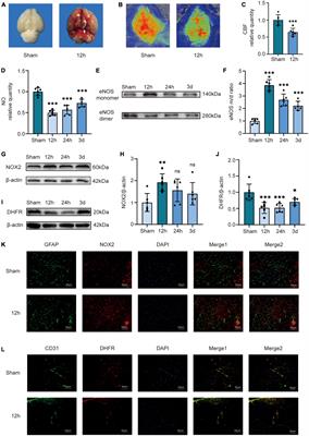Increased NOX2 expression in astrocytes leads to eNOS uncoupling through dihydrofolate reductase in endothelial cells after subarachnoid hemorrhage